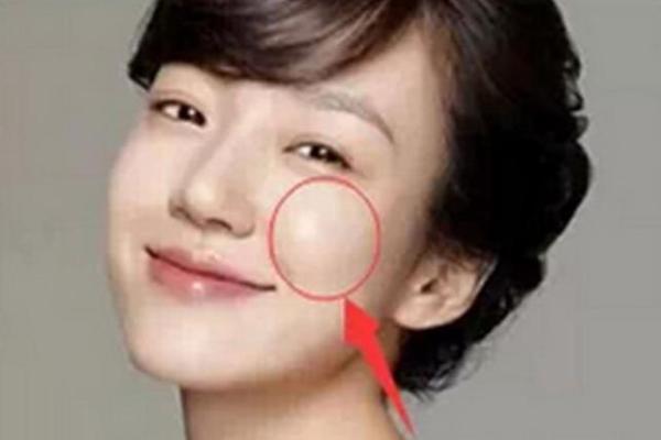 女人两腮凹陷面相的含义及其生活影响
