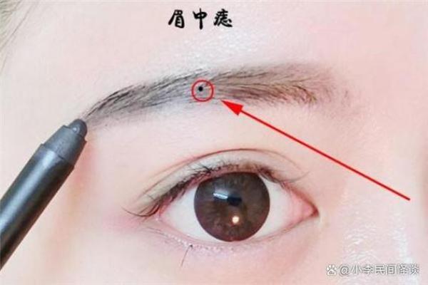 通过痣相论预测未来：你的痣点藏着什么信息