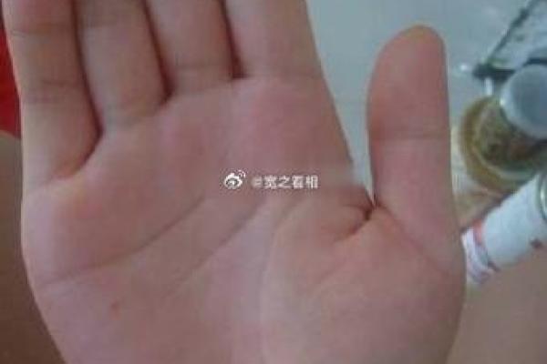 手掌痣相：从手心看出你的未来