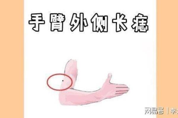 发现藏在皮肤上的财富密码，痣相与财运的深层联系