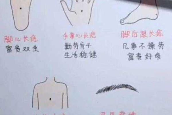 痣相与命运：科学分析与迷信观念的区别