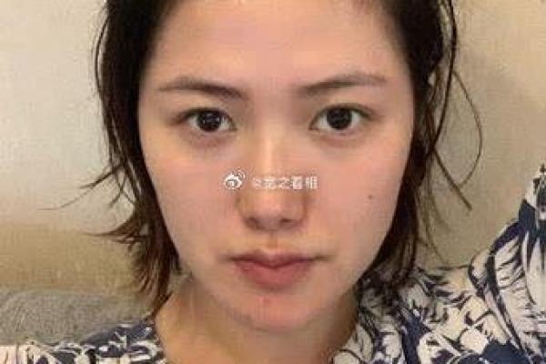鼻唇间的痣相如何影响你的性格与运势