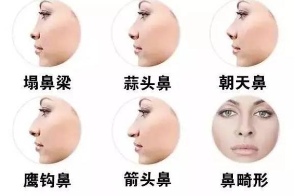 蒜头鼻女人的性格与运势深度分析
