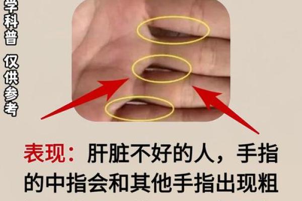 手掌上的痣有哪些特殊含义