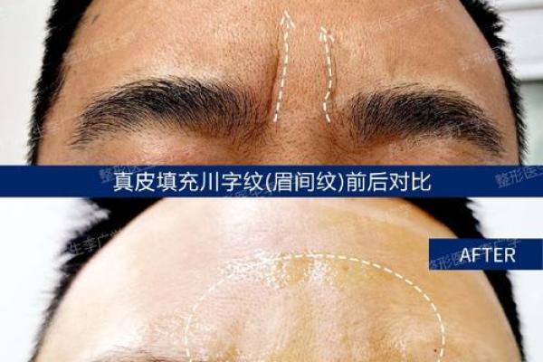 如何通过川子纹面相看你的未来运势