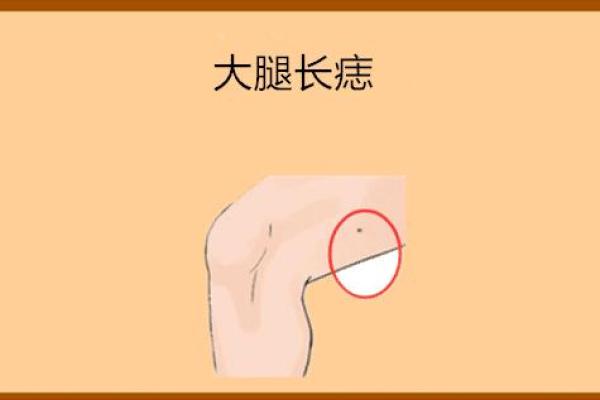 腿部痣相学：从小腿到大腿的命运解读