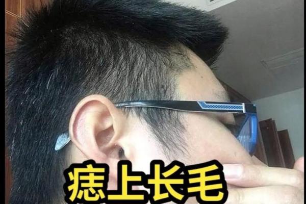痣相揭秘：从面部痣相看你的命运走向