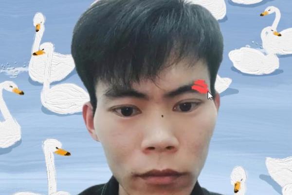 腮帮子痣相的深层意义与命运影响