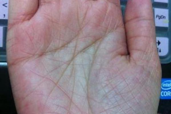 锁链纹手相解析：如何通过手掌中的链条图案预测未来