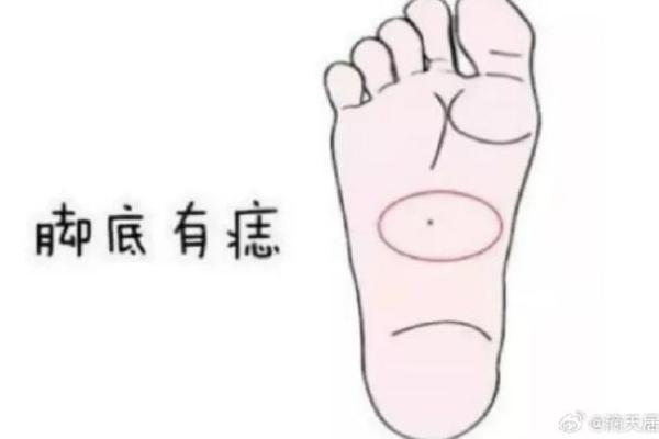 踩中命运的脚印：腿部痣相的深层解读