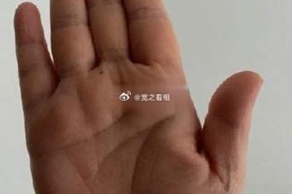 解读痣相手：如何通过手掌知未来