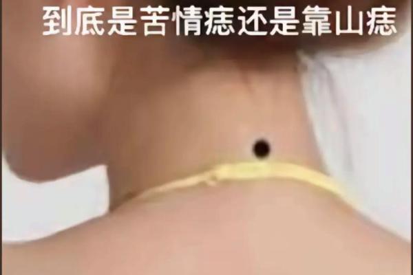 后脑勺的痣相秘密：影响你一生的命运暗示