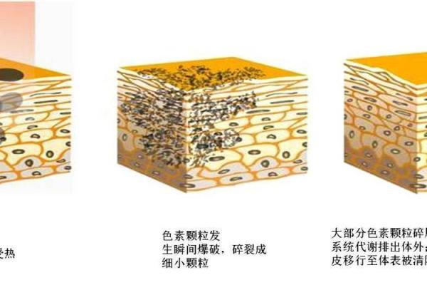 探秘相痣：你脸上的痣能透露出什么命运玄机
