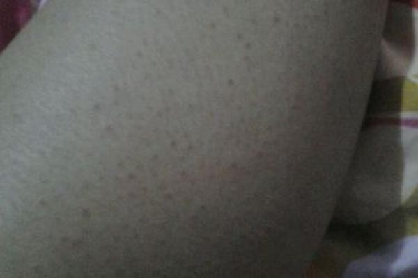 白毛藏命理，脖子上长毛竟预示着这样的命运！