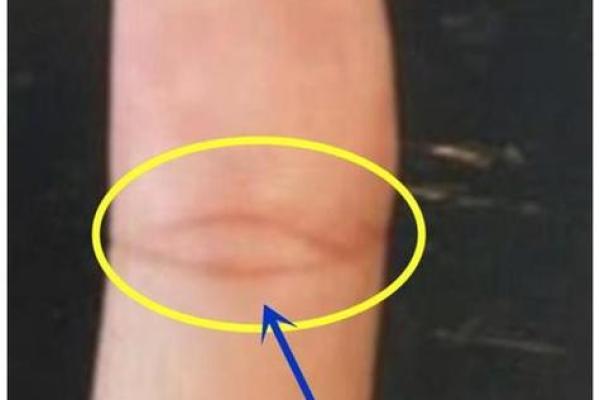 重婚手相揭秘：女性如何一眼识破