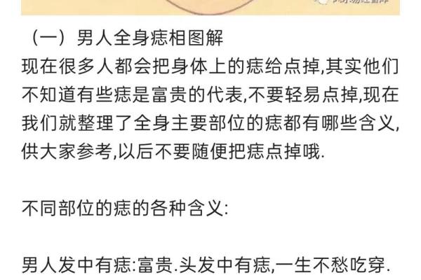 身上痣的分布，暗示男人未来命运如何？