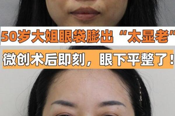 面相揭秘：父母眼袋透露的运势秘密