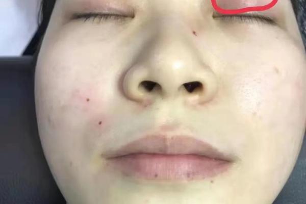 痣相预示：哪些痣相代表杀子小人？