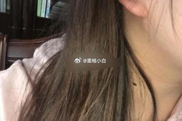 男子耳相奇观：痣相彰显非凡命运