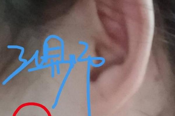 男子耳相奇观：痣相彰显非凡命运
