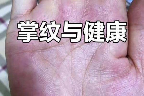 手部纹路泄露健康秘密，快来一探究竟！