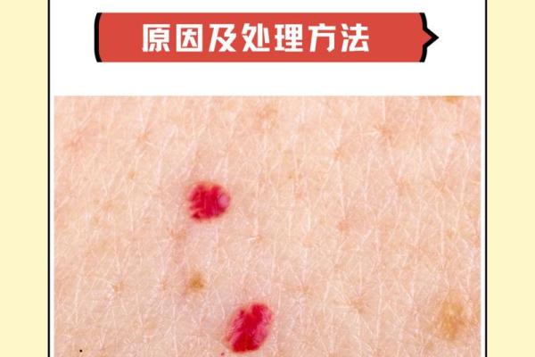 红痣运势：揭秘命理中的红运之痣