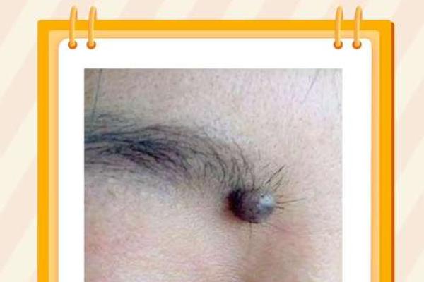 眉头藏痣的男人：揭秘他们不为人知的运势秘密