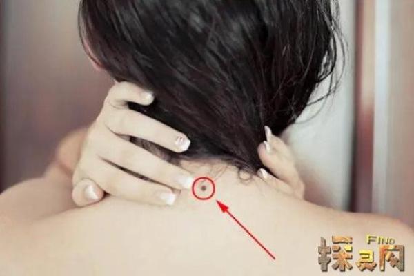 痣相解码：脖子上的痣预示着什么运势