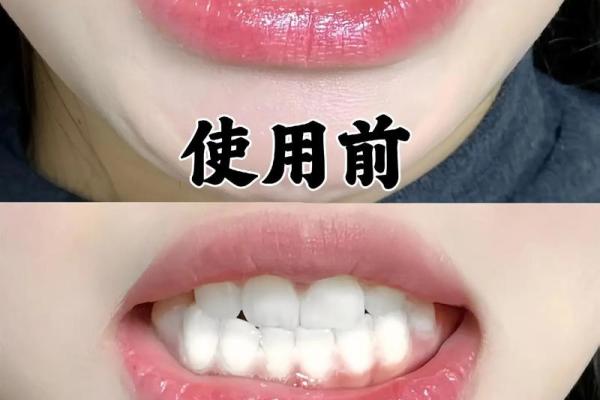 门牙旁的小秘密，解锁你的自信笑容！