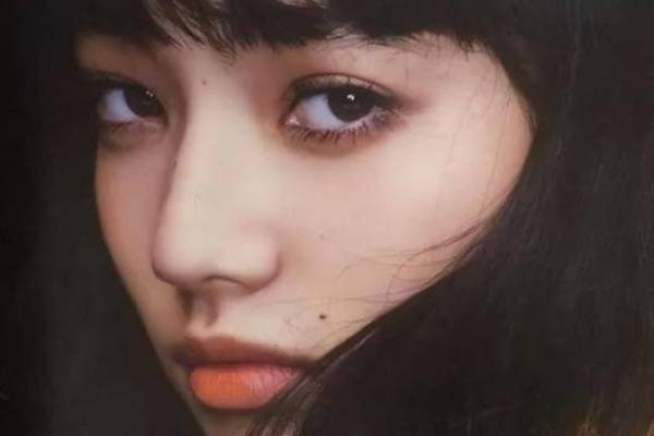 这颗痣，让我成为焦点