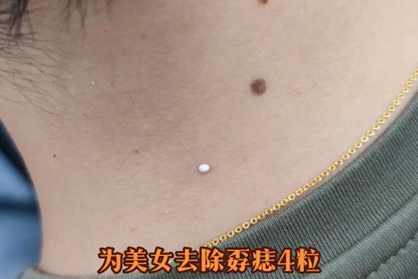 神秘魅力点：揭秘你的魅力痣