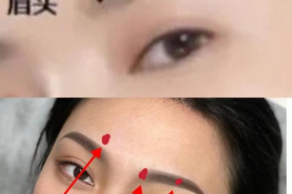眉头肉痣：你的好运符？