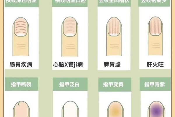 知己知彼：指甲痣相帮你洞察人心