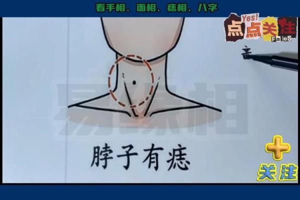 痣相解析：哪些痣相是命中注定的富贵命？