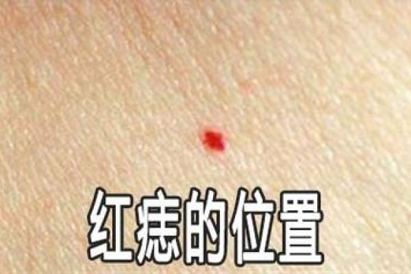 男人右颈红痣，运势与魅力的完美结合