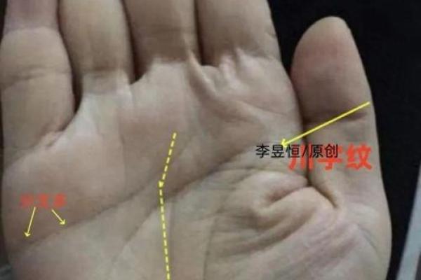惊！手相暴露健康隐患，如何逆转运势？