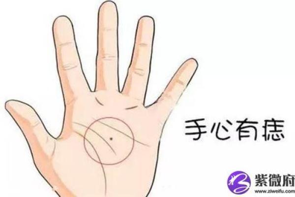 神秘脚心痣，探寻前世今生的缘分传说