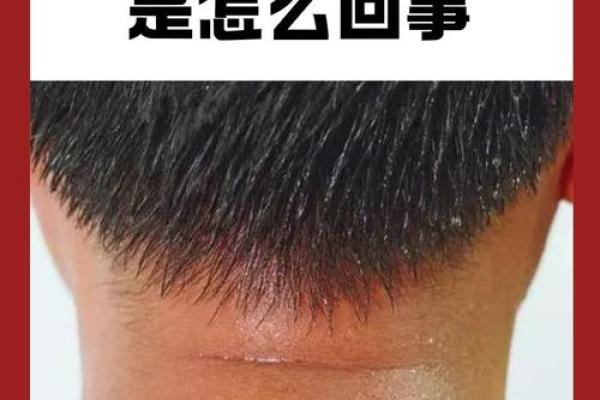 麻衣相法：鼻子有痣，是福是祸？揭秘其中奥秘