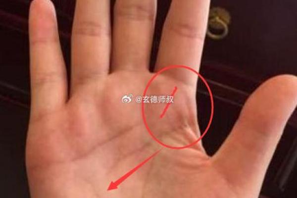 疗愈手相秘籍：揭秘大病康复的神奇手相