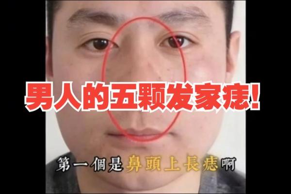 一眼识千万富翁！揭秘他们的神秘痣相！