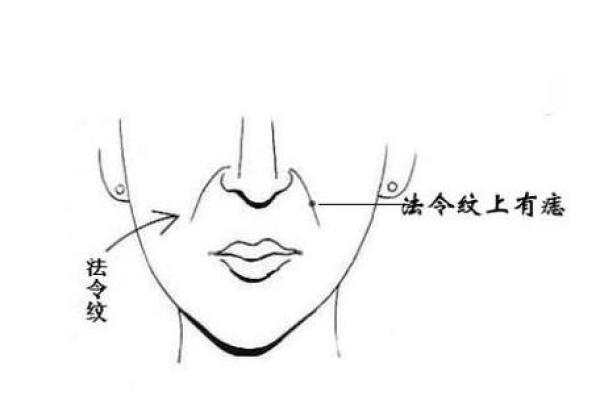 法令纹上的痣，财运、事业、爱情揭秘！
