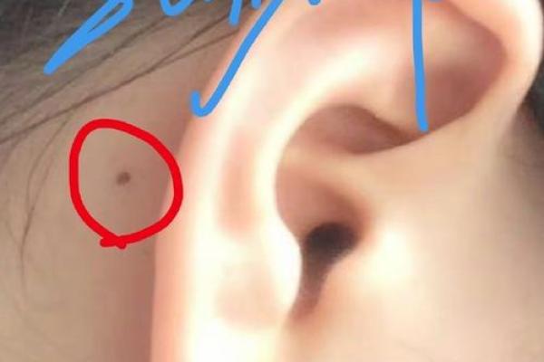 神秘痣相：女人耳朵有痣，预示着怎样的命运奇迹？