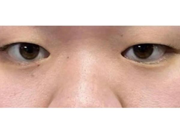 眼白多面相解析：揭秘男性面相中的白净之美