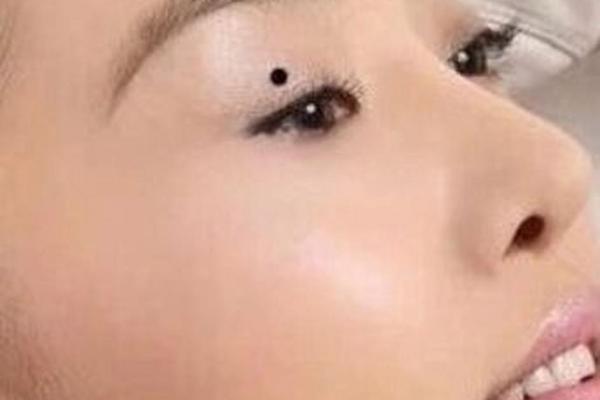 眼皮上的痣，是福是祸？一探究竟！