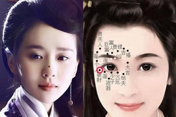 法令线痣相解析：命运密码还是美丽象征？