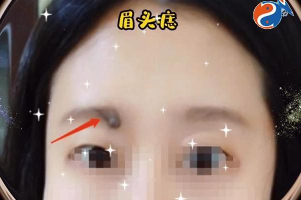 夫妻感情裂痕？揭秘预示离婚的痣相特征！