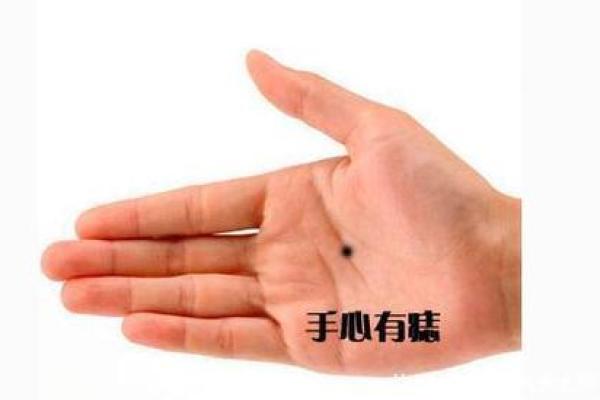 手上痣相揭秘：你的命运轨迹，一痣见分晓！
