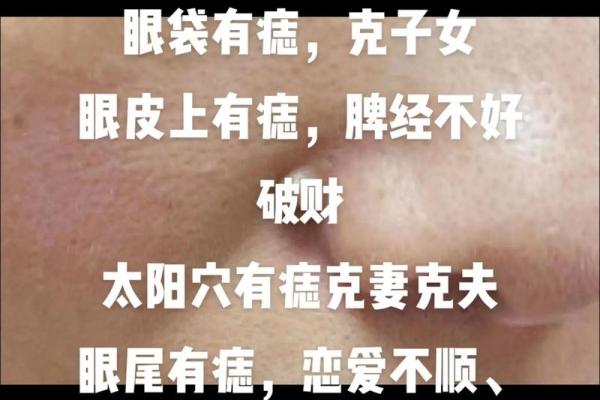 鼻痣男人运势大公开：相术界公认最准图解！