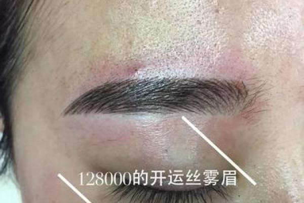 独特断眉伤疤，揭示你的命理运势，快来一探究竟