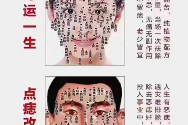 手心神秘痣，命运之谜大揭秘！